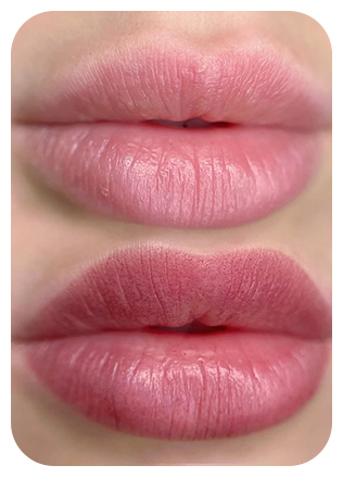 Micropigmentação labial ou micro labial com cor e contorno natural